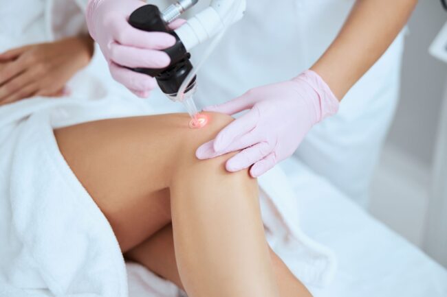 treatment for spider veins, which don't typically hurt